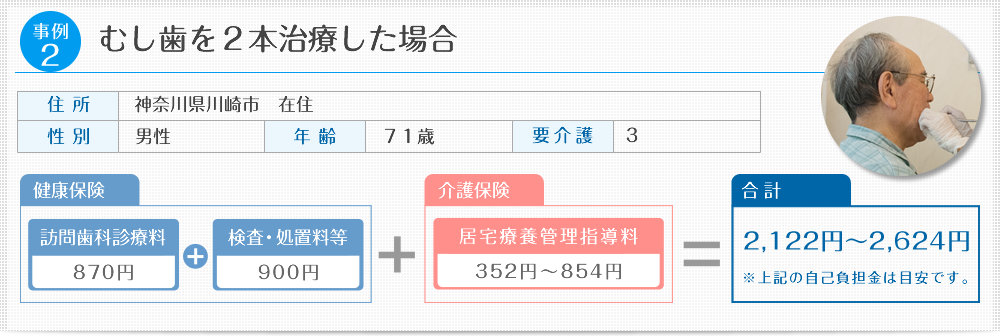 むし歯を２本治療した場合：訪問歯科診療料(830円)＋検査・処置料等(900円)
＋介護保険：居宅療養管理指導料(350円～850円)→2,080円～2,580円